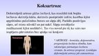 Prezentācija 'Koksartroze', 2.