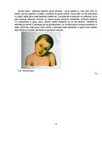 Referāts 'Masāžas skolā', 17.