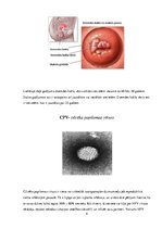 Referāts 'Dzemdes kakla vēzis', 4.