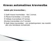 Prezentācija 'Šosejas transports - kravas automobiļi', 10.