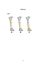 Referāts 'Femur diafizārie lūzumi', 14.