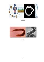 Referāts 'Medicīniskā parazitoloģija', 23.