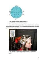 Referāts 'Elektroencefalogrammas reģistrēšanas metodika, izmantojot datorprogrammu Win EEG', 23.