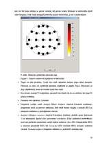 Referāts 'Elektroencefalogrammas reģistrēšanas metodika, izmantojot datorprogrammu Win EEG', 26.