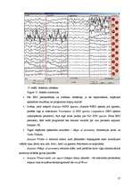 Referāts 'Elektroencefalogrammas reģistrēšanas metodika, izmantojot datorprogrammu Win EEG', 27.