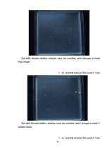 Referāts 'Mikroorganismi mums apkārt', 16.