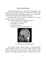 Referāts 'Magnētiskās rezonanses tomogrāfs', 16.