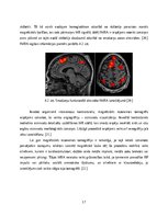 Referāts 'Magnētiskās rezonanses tomogrāfs', 17.