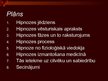 Prezentācija 'Hipnoze', 2.