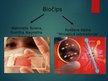Prezentācija 'Biočipi vēža diagnostikā un ārstēšanā', 3.