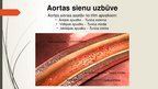 Prezentācija 'Aorta', 4.