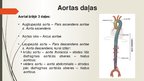 Prezentācija 'Aorta', 10.