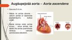 Prezentācija 'Aorta', 11.