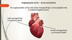 Prezentācija 'Aorta', 12.