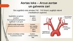 Prezentācija 'Aorta', 13.