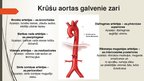 Prezentācija 'Aorta', 15.