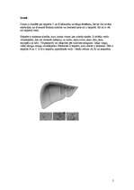 Referāts 'Vīrushepatīti', 2.