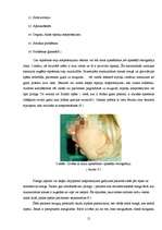 Referāts 'Miegs', 13.