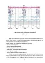Referāts 'Miegs', 15.