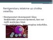 Prezentācija 'Rentgenstarojums, Gammas starojums', 8.