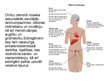 Prezentācija 'Estrogēna un progesterona ietekme uz sievietes veselību', 4.