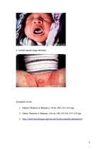 Referāts 'Sēnīšu infekcijas jaundzimušajiem', 8.