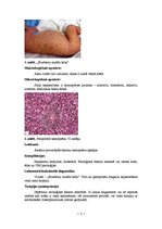 Konspekts 'Kļūdu labojums patoloģijā', 3.