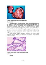 Konspekts 'Kļūdu labojums patoloģijā', 10.