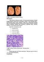 Konspekts 'Kļūdu labojums patoloģijā', 13.