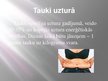 Prezentācija 'Tauki', 7.