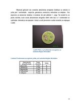 Referāts 'Antibiotikas un rezistence pret tām', 18.