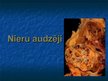 Prezentācija 'Nieru audzēji', 1.