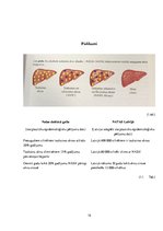 Referāts 'Nealkohola taukaina aknu slimība', 15.