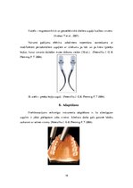 Diplomdarbs 'Ultraskaņas aparātu lietošana zobu higiēnistu darbā', 18.