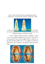 Diplomdarbs 'Ultraskaņas aparātu lietošana zobu higiēnistu darbā', 20.