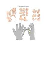 Konspekts 'Ģenētiskās slimības. Polidaktīlija', 4.