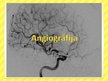 Prezentācija 'Angiogrāfija', 1.