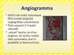Prezentācija 'Angiogrāfija', 6.