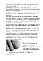 Referāts 'Pēdu pediatrija. Plakanā pēda', 4.