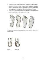 Referāts 'Pēdu pediatrija. Plakanā pēda', 11.