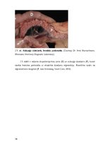 Referāts 'Kaķu pankreatīts', 10.