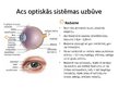Prezentācija 'Acs optiskā sistēma', 5.