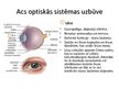 Prezentācija 'Acs optiskā sistēma', 7.