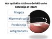 Prezentācija 'Acs optiskā sistēma', 10.