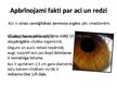 Prezentācija 'Acs optiskā sistēma', 24.
