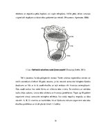 Referāts 'Plaisājošu papēžu veidošanās iemesli un profilakse', 14.