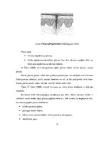 Referāts 'Plaisājošu papēžu veidošanās iemesli un profilakse', 15.