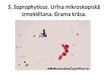 Prezentācija 'Staphylococcus saprophyticus baktērijas', 5.