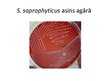 Prezentācija 'Staphylococcus saprophyticus baktērijas', 7.