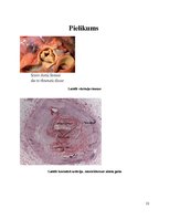 Referāts 'Hroniska sirds mazspēja', 13.